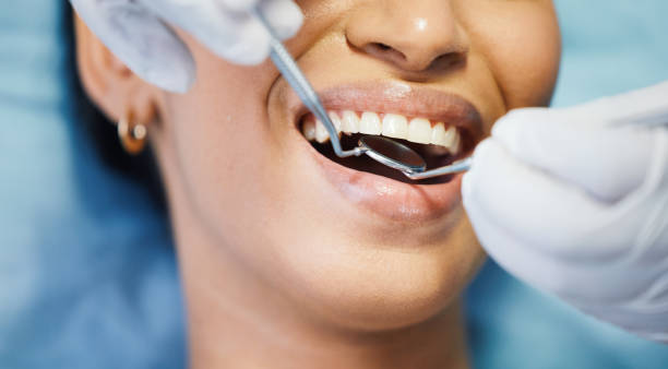 Best Broken or Cracked Tooth Emergency Dentist in Sarasota Springs, FL